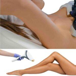 LASER DIODE – ÉPILATION DÉFINITIVE (Zones Simples)