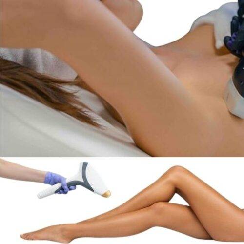 LASER DIODE – ÉPILATION DÉFINITIVE (Zones Simples)